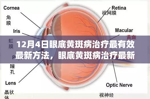 眼底黄斑病治疗最新方法深度探讨与观点阐述，有效治疗策略分析