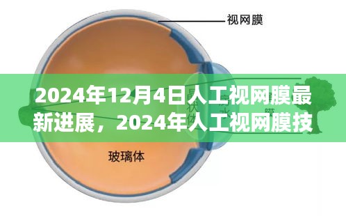 2024年人工视网膜技术最新进展与未来展望