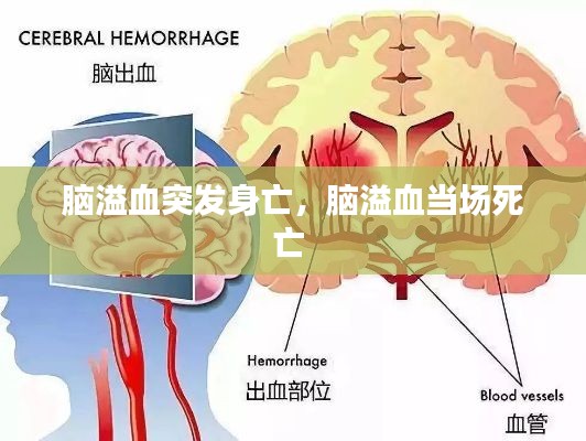 脑溢血突发身亡，脑溢血当场死亡 